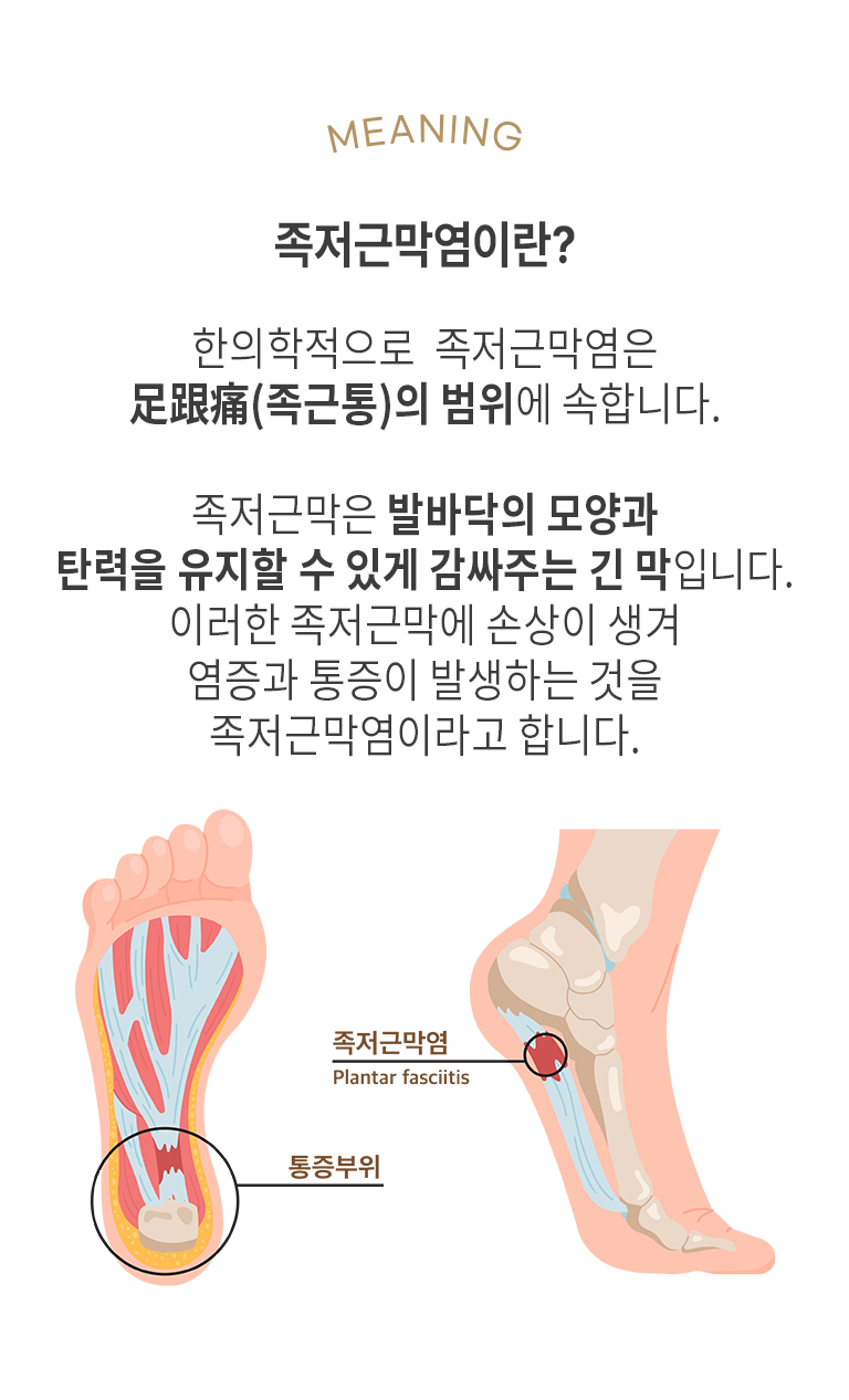 MEANING 족저근막염이란? 한의학적으로 족저근막염은 족근통의 범위에 속합니다. 족저근막은 발바닥의 모양과 탄력을 유지할 수 있게 감싸주는 긴 막입니다. 이러한 족저근막에 손상이 생겨 염증과 통증이 발생하는 것을 족저근막염이라고 합니다.