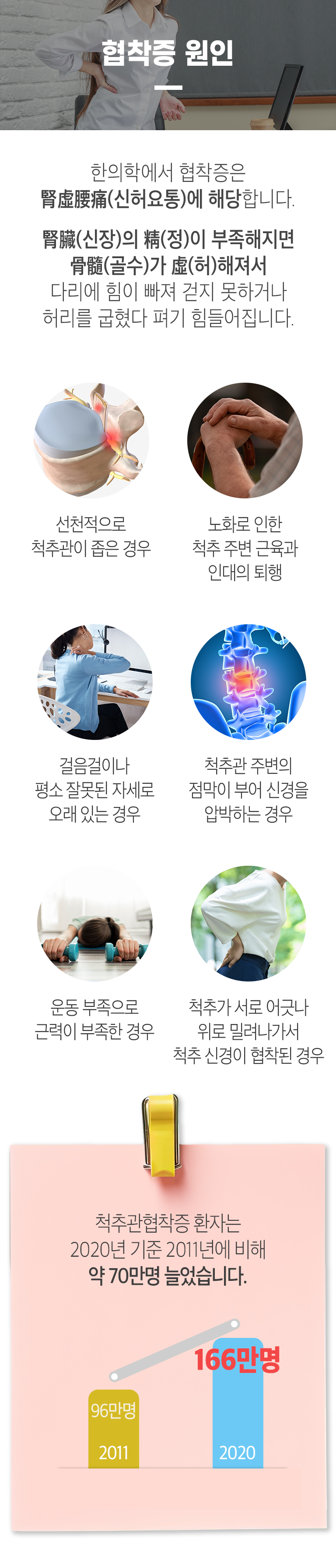 협착증 원인 ▷ 한의학에서 협착증은 腎虛腰痛(신허요통)에 해당합니다. 腎臟(신장)의 精(정)이 부족해지면 骨髓(골수)가 虛(허)해져서 다리에 힘이 빠져 걷지 못하거나 허리를 굽혔다 펴기 힘들어집니다. 선천적으로 척추관이 좁은 경우, 노화로 인한 척추 주변 근육과 인대의 퇴행, 걸음걸이나 펴소 잘못된 자세로 오래 있는 경우, 척추관 주변의 점막이 부어 신경을 압박하는 경우, 운동 부족으로 근력이 부족한 경우, 척추가 서로 어긋나 위로 밀려나가서 척추 신경이 협착된 경우. 척추관협착증 환자는 2020년 기준 2011년에 비해 약 70만명 늘었습니다. 2011년 96만명, 2020년 166만명.