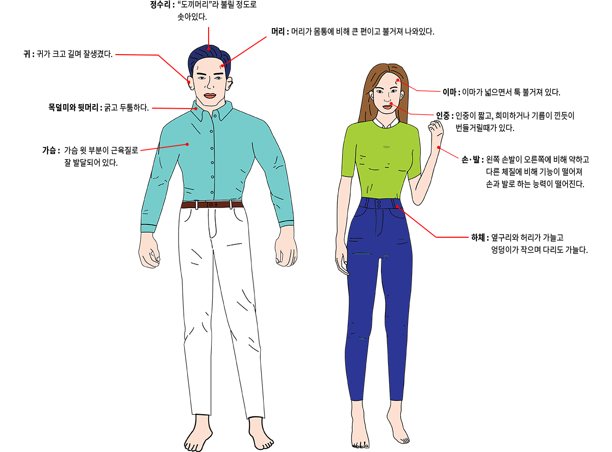 정수리 : 도끼머리라 불릴 정도로 솟아있다. 머리 : 머리가 몸통에 비해 큰 편이고 불거져 나와있다. 귀 : 귀가 크고 길며 잘생겼다. 목덜미와 뒷머리 : 굵고 두툼하다. 가슴 : 가슴 윗 부분이 근육질로 잘 발달되어 있다. 이마 : 이마가 넓으면서 툭 불거져 있다. 인중 : 인중이 짧고, 희미하거나 기름이 낀듯이 번들거릴 때가 있다. 손·발 : 왼쪽 손발이 오른쪽에 비해 약하고 다른 체질에 비해 기능이 떨어져 손과 발로 하는 능력이 떨어진다. 하체 : 옆구리와 허리가 가늘고 엉덩이가 작으며 다리도 가늘다.