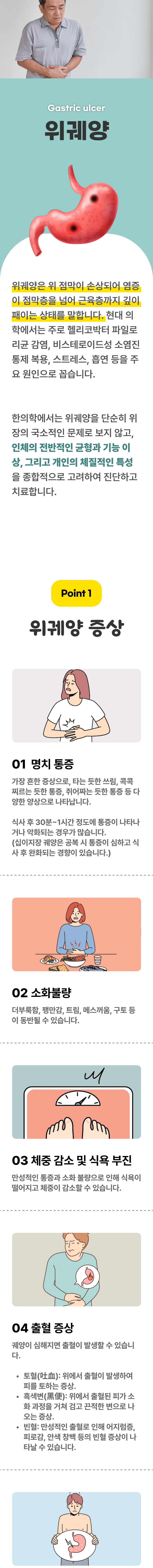 위궤양 ▷ 위궤양은 위 점막이 손상되어 염증이 점막층을 넘어 근육층까지 깊이 패이는 상태를 말합니다. 현대 의학에서는 주로 헬리코박터 파일로리균 감염, 비스테로이드성 소염진통제 복용, 스트레스, 흡연 등을 주요 원인으로 꼽습니다. 한의학에서는 위궤양을 단순히 위장의 국소적인 문제로 보지 않고, 인체의 전반적인 균형과 기능 이상, 그리고 개인의 체질적인 특성을 종합적으로 고려하여 진단하고 치료합니다. Point 1 위궤양 증상 ▷ 01 명치 통증 - 가장 흔한 증상으로, 타는 듯한 쓰림, 콕콕 찌르는 듯한 통증, 쥐어짜는 듯한 통증 등 다양한 양상으로 나타납니다. 식사 후 30분~1시간 정도에 통증이 나타나거나 악화되는 경우가 많습니다.(십이지장 궤양은 공복 시 통증이 심하고 식사 후 완화되는 경향이 있습니다.) 02 소화불량 - 더부룩함, 팽만감, 트림, 메스꺼움, 구토 등이 동반될 수 있습니다. 03 체중 감소 및 식욕 부진 - 만성적인 통증과 소화 불량으로 인해 식욕이 떨어지고 체중이 감소할 수 있습니다. 04 출혈 증상 - 궤양이 심해지면 출혈이 발생할 수 있습니다. 토혈(吐血) : 위에서 출혈이 발생하여 피를 토하는 증상. 흑색변(黑便) : 위에서 출혈된 피가 소화 과정을 거쳐 검고 끈적한 변으로 나오는 증상. 빈혈 : 만성적인 출혈로 인해 어지럼증, 피로감, 안색 창백 등의 빈혈 증상이 나타날 수 있습니다.
