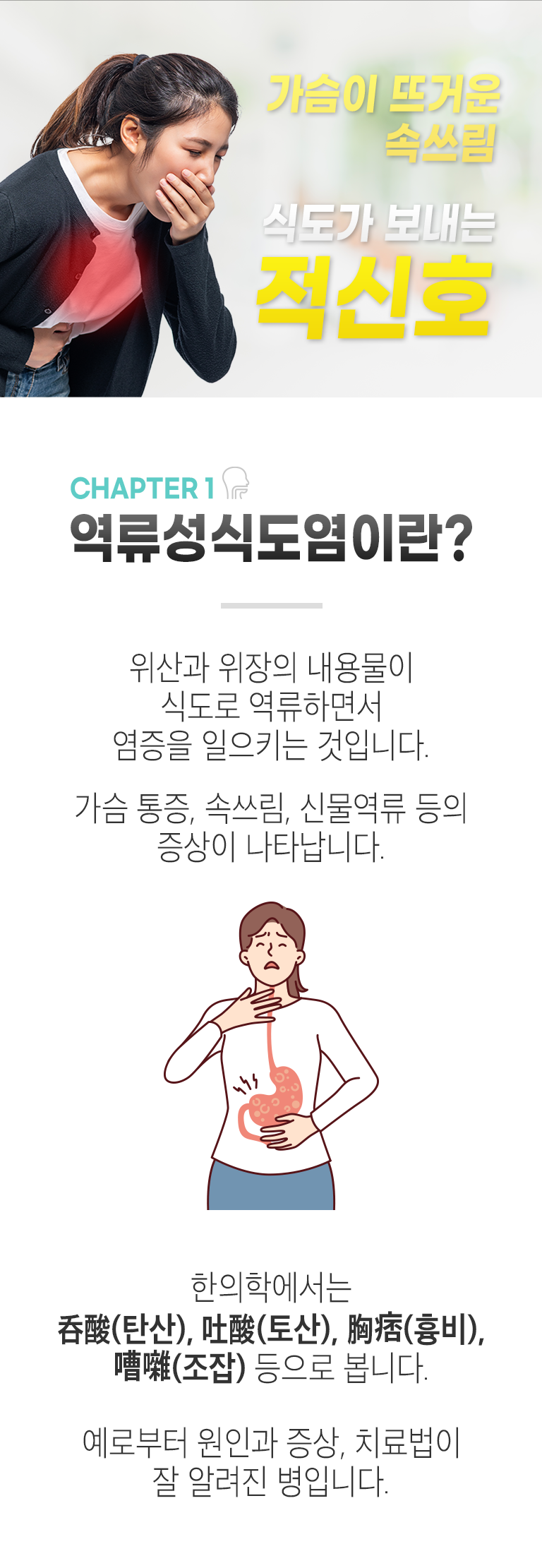 가슴이 뜨거운 속쓰림. 식도가 보내는 신호. CHAPTER 1 역류성식도염이란? ▷ 위산과 위장의 내용물이 식도로 역류하면서 염증을 일으키는 것입니다. 가슴 통증, 속쓰림, 신물역류 등의 증상이 나타납니다. 한의학에서는 呑酸(탄산), 吐酸(토산), 胸痞(흉비), 嘈雜(조잡) 등으로 봅니다. 예로부터 원인과 증상, 치료법이 잘 알려진 병입니다.