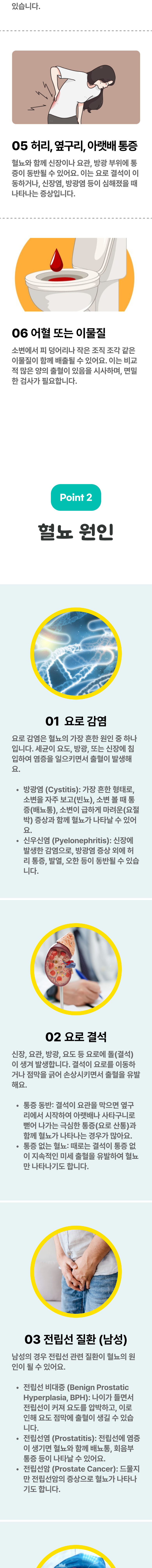 5. 허리, 옆구리, 아랫배 통증 - 혈뇨와 함께 신장이나 요관, 방광 부위에 통증이 동반될 수 있어요. 이는 요로 결석이 이동하거나, 신장염, 방광염 등이 심해졌을 때 나타나는 증상입니다. 6. 어혈 또는 이물질 - 소변에서 피 덩어리나 작은 조직 조각 같은 이물질이 함께 배출될 수 있어요. 이는 비교적 많은 양의 출혈이 있음을 시사하며, 면밀한 검사가 필요합니다. 02 혈뇨 원인 ▷ 1. 요로 감염 - 요로 감염은 혈뇨의 가장 흔한 원인 중 하나입니다. 세균이 요도, 방광, 또는 신장에 침입하여 염증을 일으키면서 출혈이 발생해요. 방광염(Cystitis) : 가장 흔한 형태로, 소변을 자주 보고(빈뇨), 소변 볼 때 통증(배뇨통), 소변이 급하게 마려운(요절박) 증상과 함께 혈뇨가 나타날 수 있어요. 신우신염(Pyelonephritis) : 신장에 발생한 감염으로, 방광염 증상 외에 허리 통증, 발열, 오한 등이 동반될 수 있습니다. 2. 요로 결석 - 신장, 요관, 방광, 요도 등 요로에 돌(결석)이 생겨 발생합니다. 결석이 요로를 이동하거나 점막을 긁어 손상시키면서 출혈을 유발해요. 통증 동반 : 결석이 요관을 막으면 옆구리에서 시작하여 아랫배나 사타구니로 뻗어 나가는 극심한 통증(요로 산통)과 함께 혈뇨가 나타나는 경우가 많아요. 통증 없는 혈뇨 : 때로는 결석이 통증 없이 지속적인 미세 출혈을 유발하여 혈뇨만 나타나기도 합니다. 3. 전립선 질환(남성) - 남성의 경우 전립선 관련 질환이 혈뇨의 원인이 될 수 있어요. 전립선 비대증(Benign Prostatic Hyperplasia. BPH) : 나이가 들면서 전립선이 커져 요도를 압박하고, 이로 인해 요도 점막에 출혈이 생길 수 있습니다. 전립선염(Prostatitis) : 전립선에 염증이 생기면 혈뇨와 함께 배뇨통, 회음부 통증 등이 나타날 수 있어요. 전립선암(Prostate Cancer) : 드물지만 전립선암의 증상으로 혈뇨가 나타나기도 합니다.