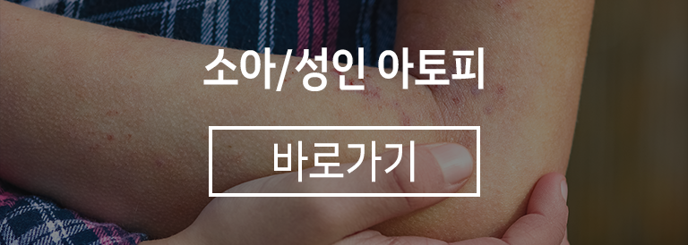 소아/성인 아토피 바로가기