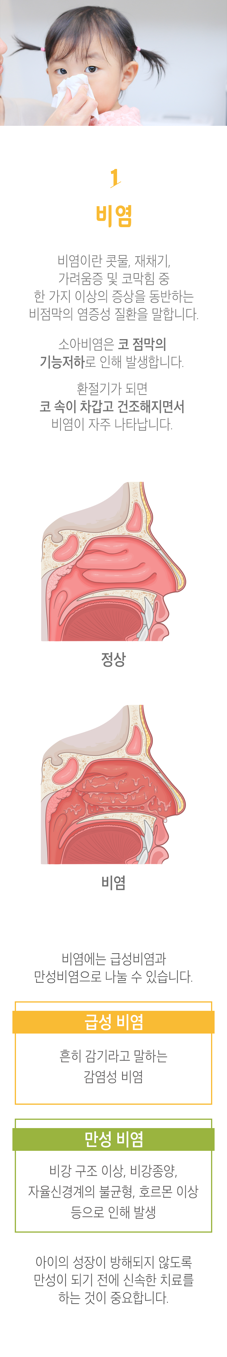 01 비염 ▷ 비염이란 콧물, 재채기, 가려움증 및 코막힘 중 한 가지 이상의 증상을 동반하는 비점막의 염증성 질환을 말합니다. 소아비염은 코 점막의 기능저하로 인해 발생합니다. 환절기가 되면 코 속이 차갑고 건조해지면서 비염이 자주 나타납니다. 비염에는 급성비염과 만성비염으로 나눌 수 있습니다. 급성 비염 - 흔히 감기라고 말하는 감염성 비염. 만성 비염 - 비강 구조 이상, 비강종양, 자율신경계의 불균형, 호르몬 이상 등으로 인해 발생. 아이의 성장이 방해되지 않도록 만성이 되기 전에 신속한 치료를 하는 것이 중요합니다.