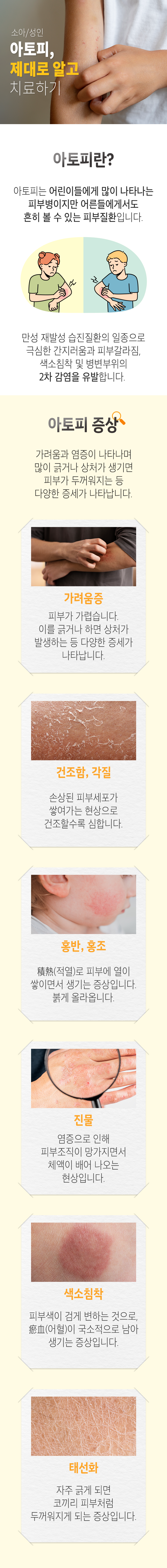 소아/성인 아토피, 제대로 알고 치료하기. 아토피란? ▷ 아토피는 어린이들에게 많이 나타나는 피부병이지만 어른들에게서도 흔히 볼 수 있는 피부질환입니다. 만성 재발성 습진진환의 일종으로 극심한 간지러움과 피부갈라짐, 색소침착 및 병변부위의 2차 감염을 유발합니다. 아토피 증상 ▷ 가려움과 염증이 나타나며 많이 긁거나 상처가 생기면 피부가 두꺼워지는 등 다양한 증세가 나타납니다. 가려움증 - 피부가 가렵습니다. 이를 긁거나 하면 상처가 발생하는 등 다양한 증세가 나타납니다. 건조함, 각질 - 손상된 피부세포가 쌓여가는 현상으로 건조할수록 심합니다. 홍반, 홍조 - 積熱(적열)로 피부에 열이 쌓이면서 생기는 증상입니다. 붉게 올라옵니다. 진물 - 염증으로 인해 조직이 망가지면서 체액이 배어 나오는 현상입니다. 색소침착 - 피부색이 검게 변하는 것으로, 瘀血(어혈)이 국소적으로 남아 생기는 증상입니다. 태선화 - 자주 긁게 되면 코끼리 피부처럼 두꺼워지게 되는 증상입니다.