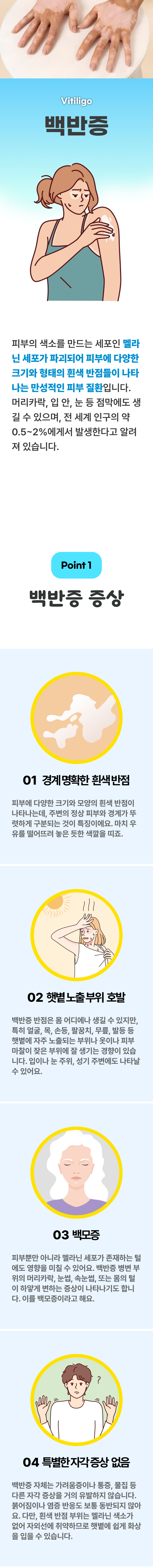 백반증 1