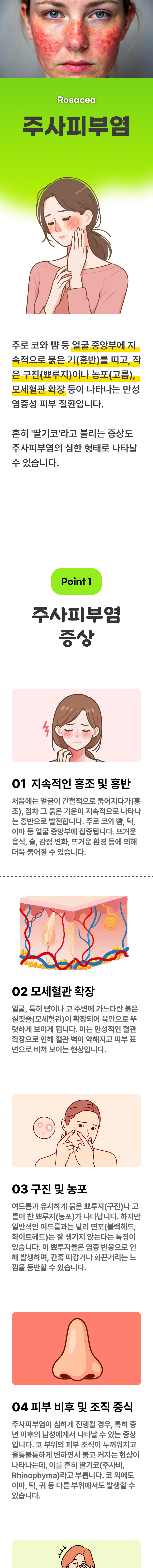 주사피부염 ▷ 주로 코와 뺨 등 얼굴 중앙부에 지속적으로 붉은 기(홍반)를 띠고, 작은 구진(뾰루지)이나 농포(고름), 모세혈관 확장 등이 나타나는 만성 염증성 피부 질환입니다. 흔히 '딸기코'라고 불리는 증상도 주사피부염의 심한 형태로 나타날 수 있습니다. 01 주사피부염 증상 ▷ 1. 지속적인 홍조 및 홍반 - 처음에는 얼굴이 간헐적으로 붉어지다가(홍조), 점차 그 붉은 기운이 지속적으로 나타나는 홍반으로 발전합니다. 주로 코와 뺨, 턱, 이마 등 얼굴 중앙부에 집중됩니다. 뜨거운 음식, 술, 감정 변화, 뜨거운 환경 등에 의해 더욱 붉어질 수 있습니다. 2. 모세혈관 확장 - 얼굴, 특히 뺨이나 코 주변에 가느다란 붉은 실핏줄(모세혈관)이 확장되어 육안으로 뚜렷하게 보이게 됩니다. 이는 만성적인 혈관 확장으로 인해 혈관 벽이 약해지고 피부 표면으로 비쳐 보이는 현상입니다. 3. 구진 및 농포 - 여드름과 유사하게 붉은 뾰루지(구진)나 고름이 찬 뾰루지(농포)가 나타납니다. 하지만 일반적인 여드름과는 달리 면포(블랙헤드, 화이트헤드)는 잘 생기지 않는다는 특징이 있습니다. 이 뾰루지들은 염증 반응으로 인해 발생하며, 간혹 따갑거나 화끈거리는 느낌을 동반할 수 있습니다. 4. 피부 비후 및 조직 증식 - 주사피부염이 심하게 진행될 경우, 특히 중년 이후의 남성에게서 나타날 수 있는 증상입니다. 코 부위의 피부 조직이 두꺼워지고 울퉁불퉁하게 변하면서 붉고 커지는 현상이 나타나는데, 이를 흔히 딸기코(주사비, Rhinophyma)라고 부릅니다. 코 외에도 이마, 턱, 귀 등 다른 부위에서도 발생할 수 있습니다.