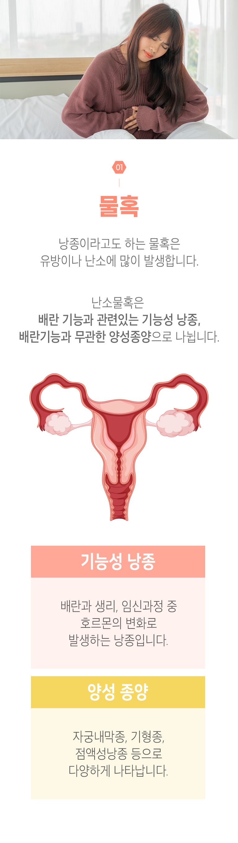 01 물혹 ▷ 낭종이라고도 하는 물혹은 유방이나 난소에 많이 발생합니다. 난소물혹은 배란 기능과 관련있는 기능성 낭종, 배란기능과 무관한 양성종양으로 나뉩니다. 기능성 낭종 ▶ 배란과 생리, 임신과정 중 호르몬의 변화로 발생하는 낭종입니다. 양성 종양 ▶ 자궁내막종, 기형종, 점액성낭종 등으로 다양하게 나타납니다.