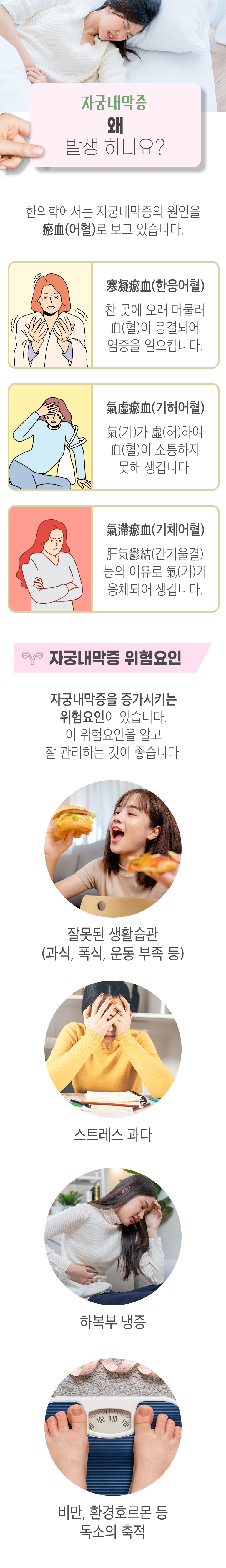 자궁내막증 왜 발생하나요? ▷ 한의학에서는 자궁내막증의 원인을 瘀血(어혈)로 보고 있습니다. 寒凝瘀血(한응어혈) - 찬 곳에 오래 머물러 血(혈)이 응결되어 염증을 일으킵니다. 氣虛瘀血(기허어혈) - 氣(기)가 虛(허)하여 血(혈)이 소통하지 못해 생깁니다. 氣滯瘀血(기체어혈) - 肝氣鬱結(간기울결) 등의 이유로 氣(기)가 응체되어 생깁니다. 자궁내막증 위험요인 ▶ 자궁내막증을 증가시키는 위험요인이 있습니다. 이 위험요인을 알고 잘 관리하는 것이 좋습니다. 잘못된 생활습관(과식, 폭식, 운동 부족 등), 스트레스 과다, 하복부 냉증, 비만, 환경호르몬 등 독소의 축적.