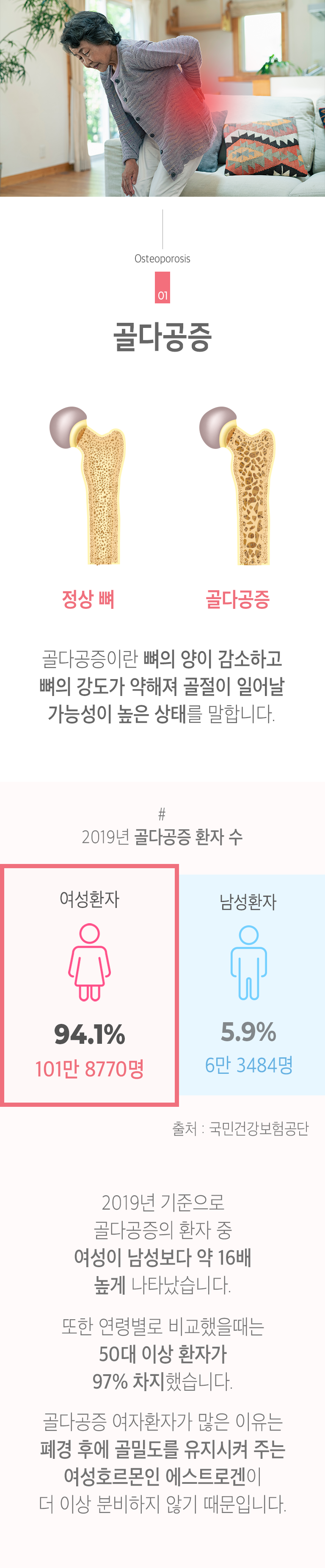 01 골다공증 ▷ 골다공증이란 뼈의 양이 감소하고 뼈의 강도가 약해져 골절이 일어날 가능성이 높은 상태를 말합니다. #2019년 골다공증 환자 수 ▶ 여성환자 94.1% 101만 8770명, 남성환자 5.9% 6만 3484명. 출처 : 국민건강보험공단. 2019년 기준으로 골다공증의 환자 중 여성이 남성보다 약 16배 높게 나타났습니다. 또한 연령별로 비교했을때는 50대 이상 환자가 97% 차지했습니다. 골다공증 여자환자가 많은 이유는 폐경 후에 골밀도를 유지시켜 주는 여성호르몬인 에스트로겐이 더 이상 분비하지 않기 때문입니다.