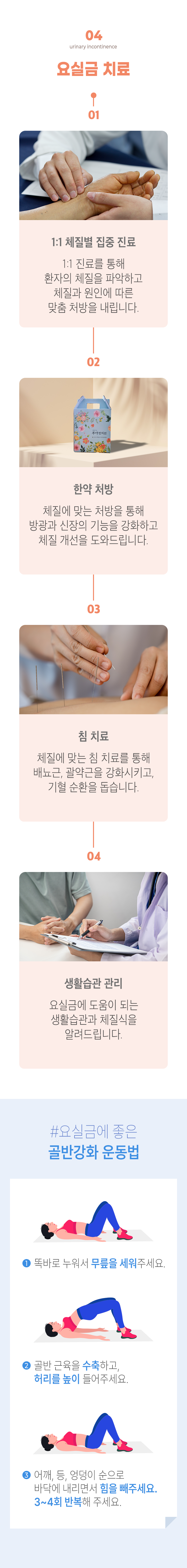 04 요실금 치료 ▷ 1. 1:1 체질별 집중 진료 - 1:1진료를 통해 환자의 체질을 파악하고 ㅊ체질과 원인에 따른 맞춤처방을 내립니다. 2. 한약 처방 - 체질에 맞는 처방을 통해 방광과 신장의 기능을 강화하고 체질 개선을 도와드립니다. 3. 침 치료 - 체질에 맞는 침 치료를 통해 배뇨근, 괄약근을 강화시키고, 기혈 순환을 돕습니다. 4. 생활습관 관리 - 요실금에 도움이 되는 생활습관과 체질식을 알려드립니다. #요실금에 좋은 골반강화 운동법 ▶ ① 똑바로 누워서 무릎을 세워주세요. ② 골반 근육을 수축하고, 허리를 높이 들어주세요. ③ 어깨, 등, 엉덩이 순으로 바닥에 내리면서 힘을 빼주세요. 3~4회 반복해 주세요.